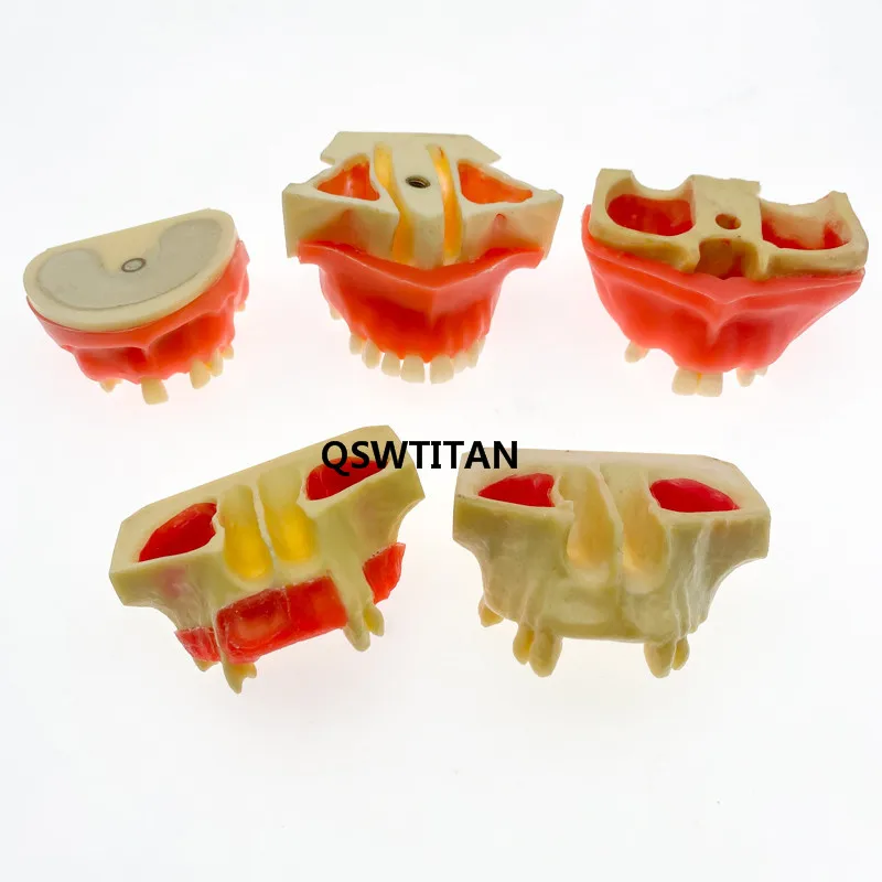 Dental Sinus Lift Practice Teeth Model Typodont Study Model Tooth model Dental teaching model