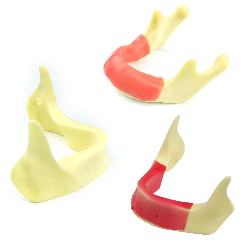 

Implant Practice Model for Teaching Dental Tooth Teeth Dentist Anatomical Anatomy Model Odontologia