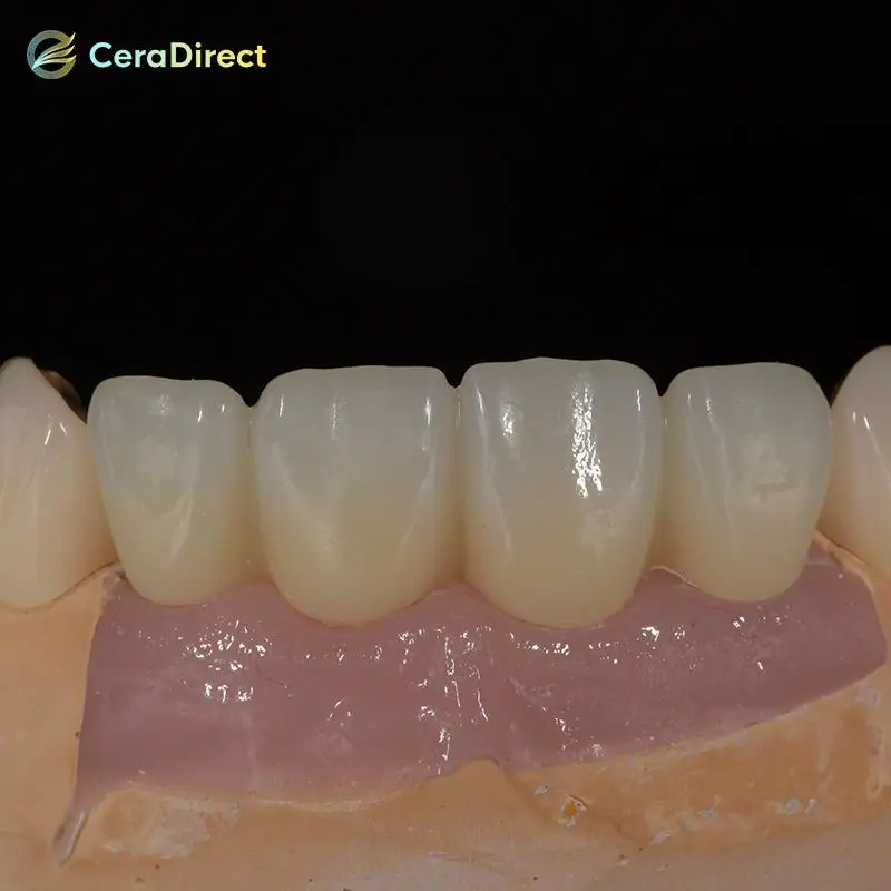 Ceradirect 3D-Pro Mehrschichtiges Zirkonoxid-AG-System (71 mm) – für Dentallabor CAD/CAM