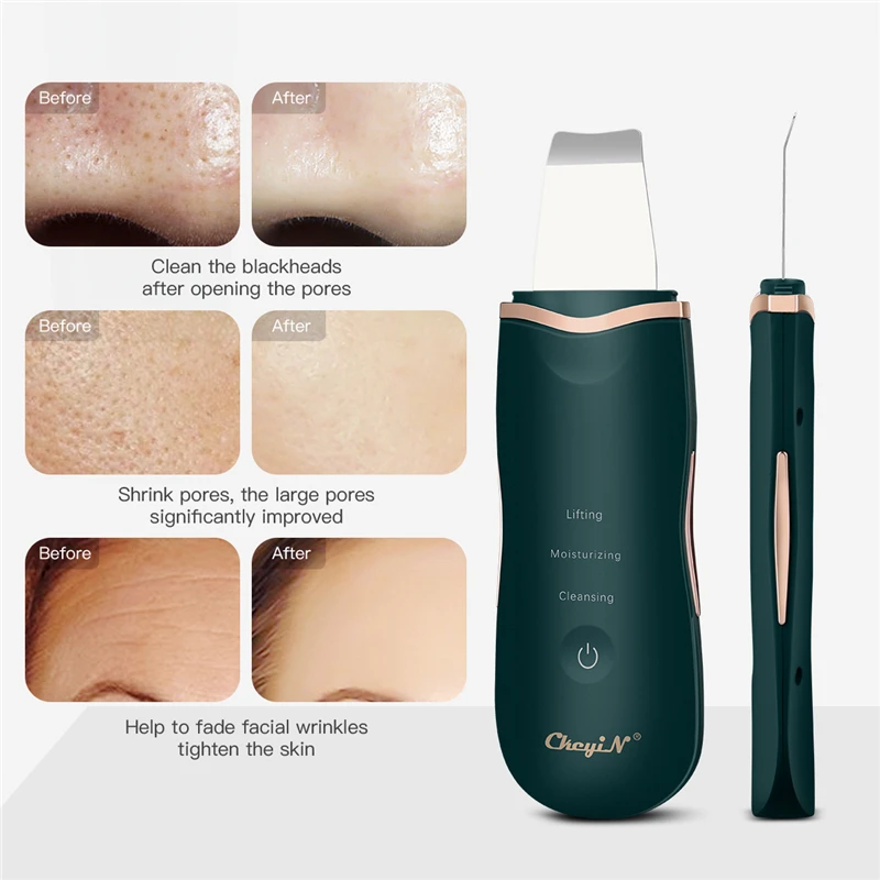 CkeyiN Ultrasonic Facial Skin Scrubber Ion Deep Face Clean + Electric Vacuum Suction estrattore di punti neri strumento pulito con 4 sonde
