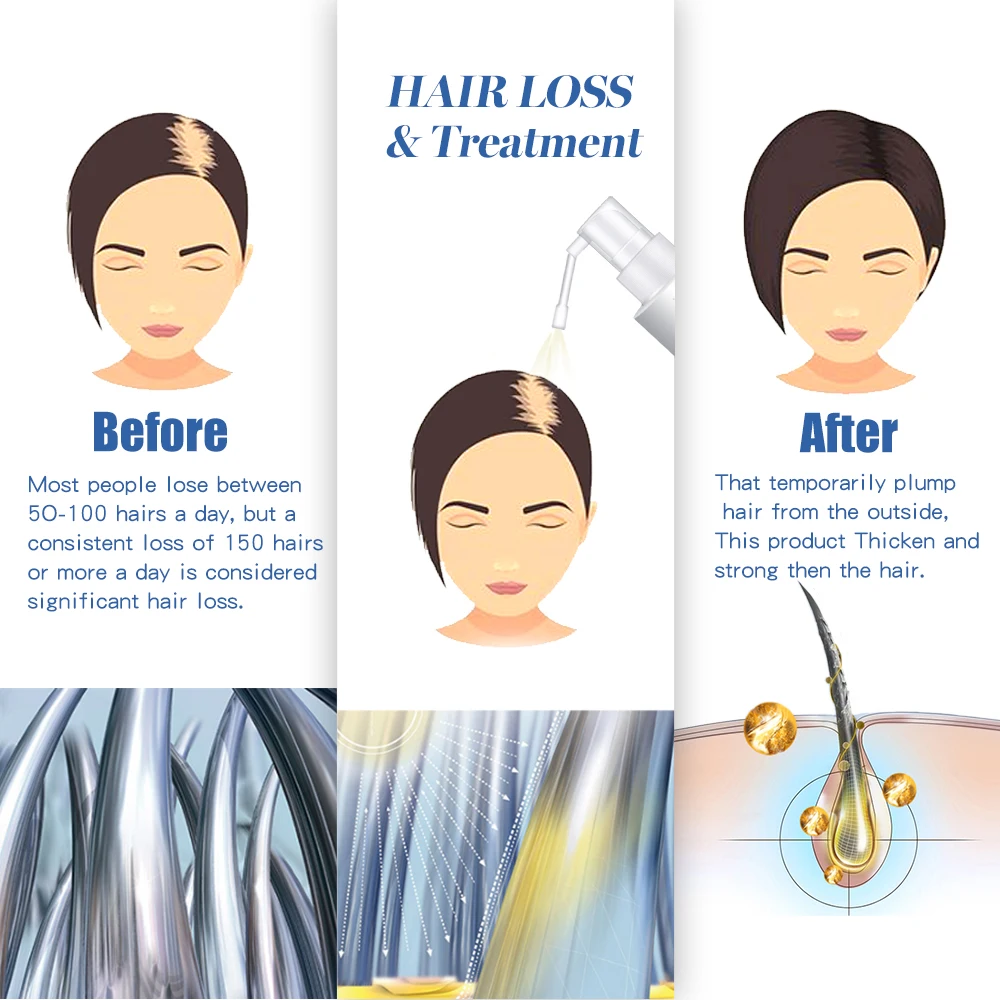 Hair Repro nutre las raíces del cabello, producto de pérdida de cabello Anit para hombres y mujeres, cuidado del cabello y la barba, tratamientos de aceite para recuperar el cabello grueso