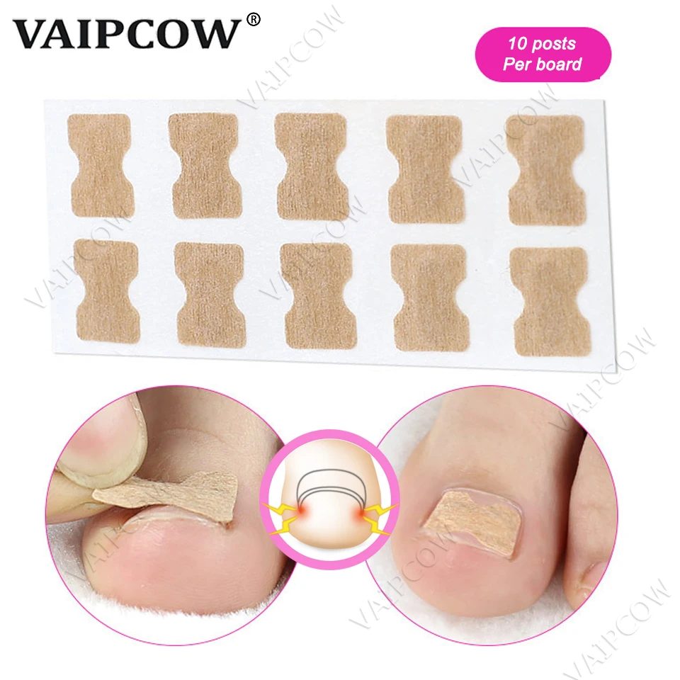 10pcs Ingrown Toenail Corrector Sticker Paronychia Treatment Fixer Recover Corrector Pedicure Foot Toe Nail Care Tool Glue Free