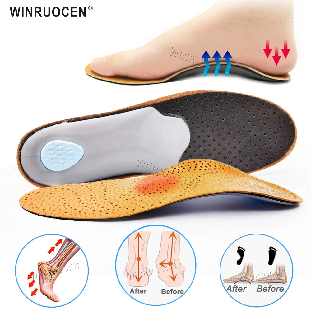 WINRUOCEN Leather Orthopedic Insoles Foot Care Arch Support O/X Leg Shoe For Flat Feet Women Men's Insole Shoes Pads