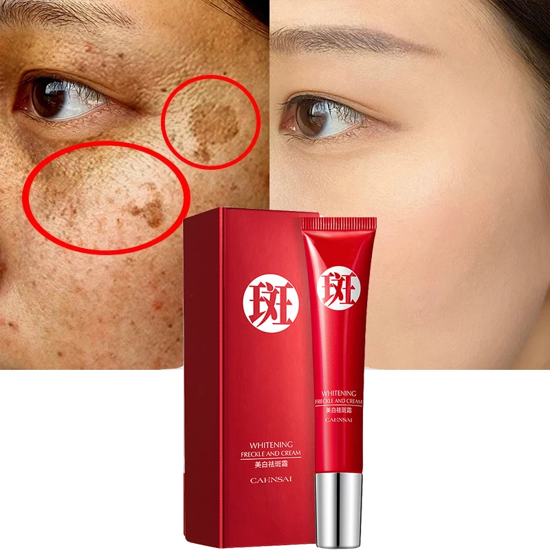 Effective Whitening Freckle Cream Remove Melasma Acne Spot Pigment Melanin Dark Spots Pigmentation Moisturizing Gel Skin Care