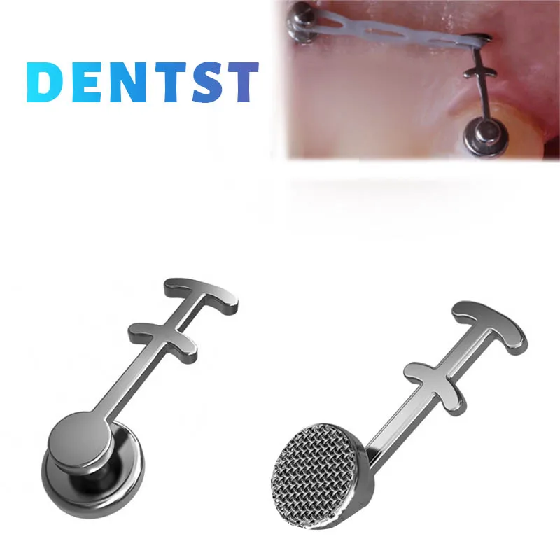 Dentst 50pcs Orthodontic Dental Direct Bond Eyelet Ceramic Lingual Buttons Tongue Tamer Bite Opener Traction Hook Crimpable Hook