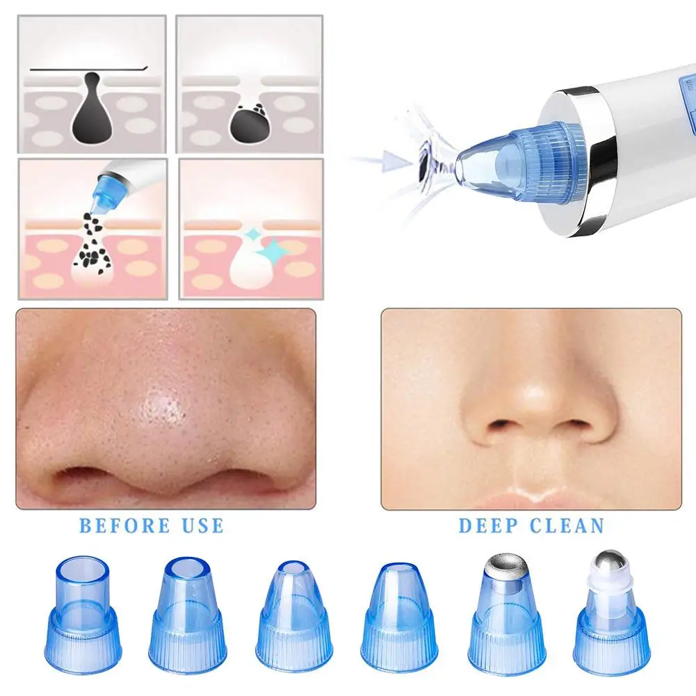 ไฟฟ้า Blackhead Remover สิวรูขุมขนทำความสะอาด Extractor ชาร์จ USB 5ระดับเครื่องมือความงามสำหรับผู้หญิงผู้ชาย