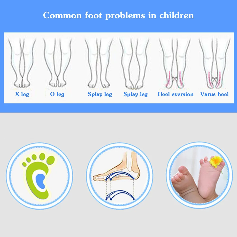 Orthopädische Einlegesohlen für Kinder, Schuheinlagen, Baby-Plattfußgewölbeunterstützung, Silikon-Gel-Einlegesohlen, orthesen für Plantarfasziitis – Detail 8