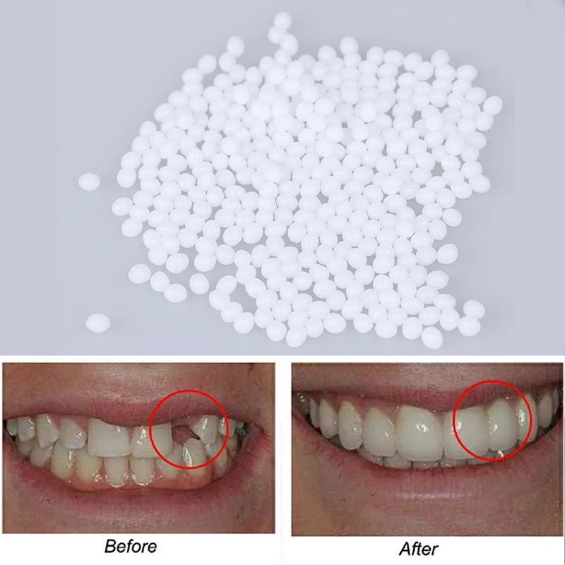 Temporary Tooth Repair Kit Teeth And Gaps FalseTeeth Solid Glue Denture Adhesive Teeth Whitening Tooth Beauty Tool 5/10/15/20g