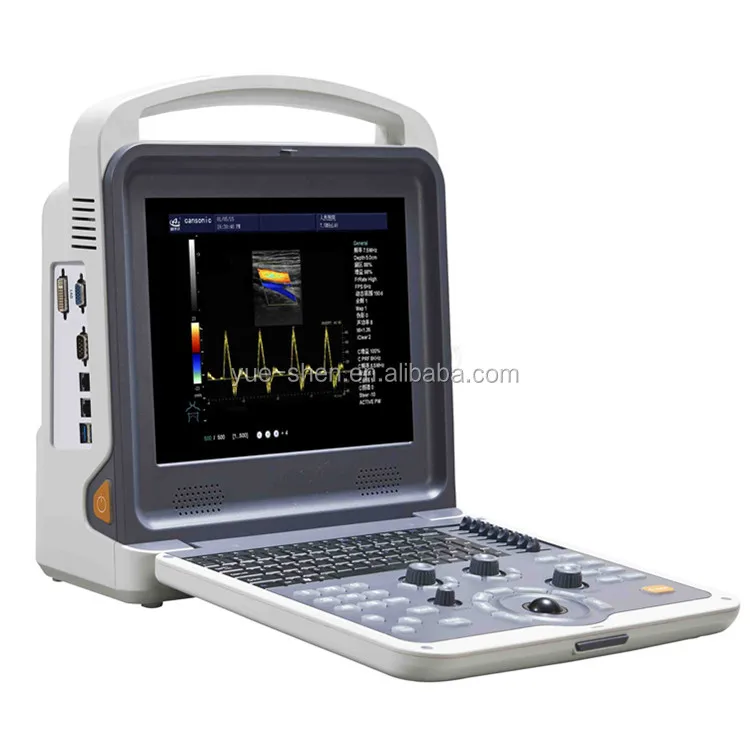 High performance most economic 3D 4D color doppler portable ultrasound