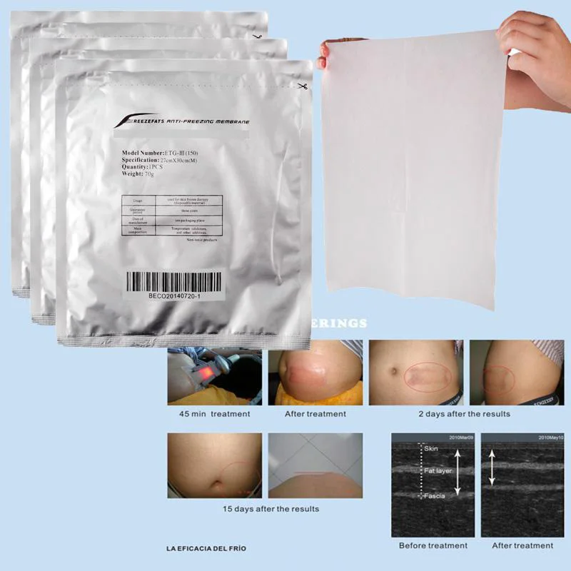 20X Anti Freeze Membrane Film Paper for Fat Freeze Liposuction Cryotherapy by Superjune Fat Cryo Cooling Weight Three Sizes