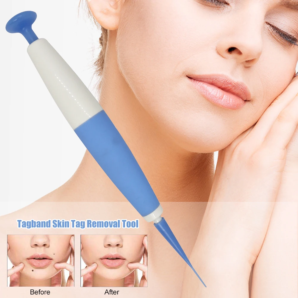 Papilloma Removal tool For Small To Medium Face Care blue Micro band Skin Tag Remover Kit Corn With Cleansing Swabs Mole Wart