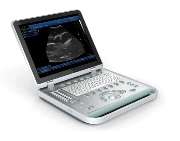 15 in LED screen notebook ultrasound free shipping