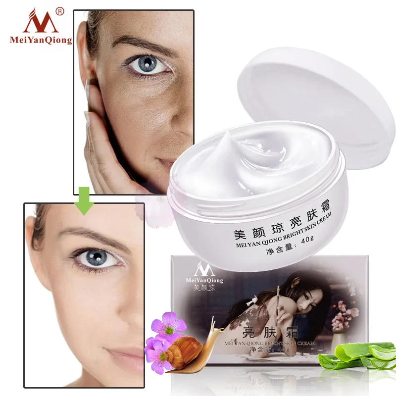 MeiYanQiong Powerful Remove Freckle Whitening Cream Remove Melasma Dark Spots Pigment Melanin Strong Effects Brightening Cream