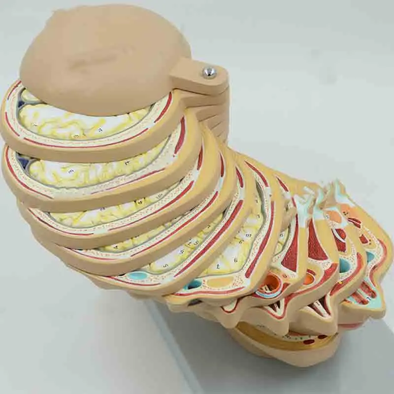 The teaching of CT MRI brain model and radiation magnetic resonance imaging