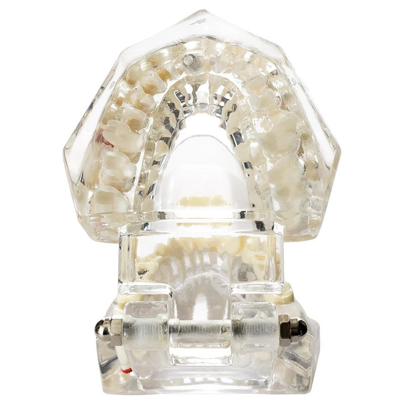 Dental Model Teeth Implant Restoration Bridge Teaching Study Medical Science Disease Dentist Dentistry Products Dental Gift