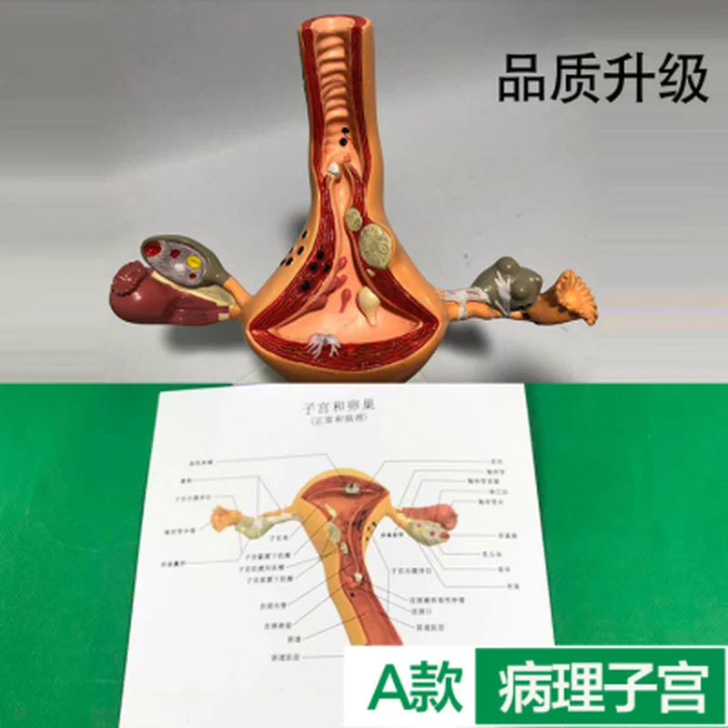 Ovary and uterus disease Dissection model Pathology Female uterus model teaching human medical aids anatomy lesion uterus