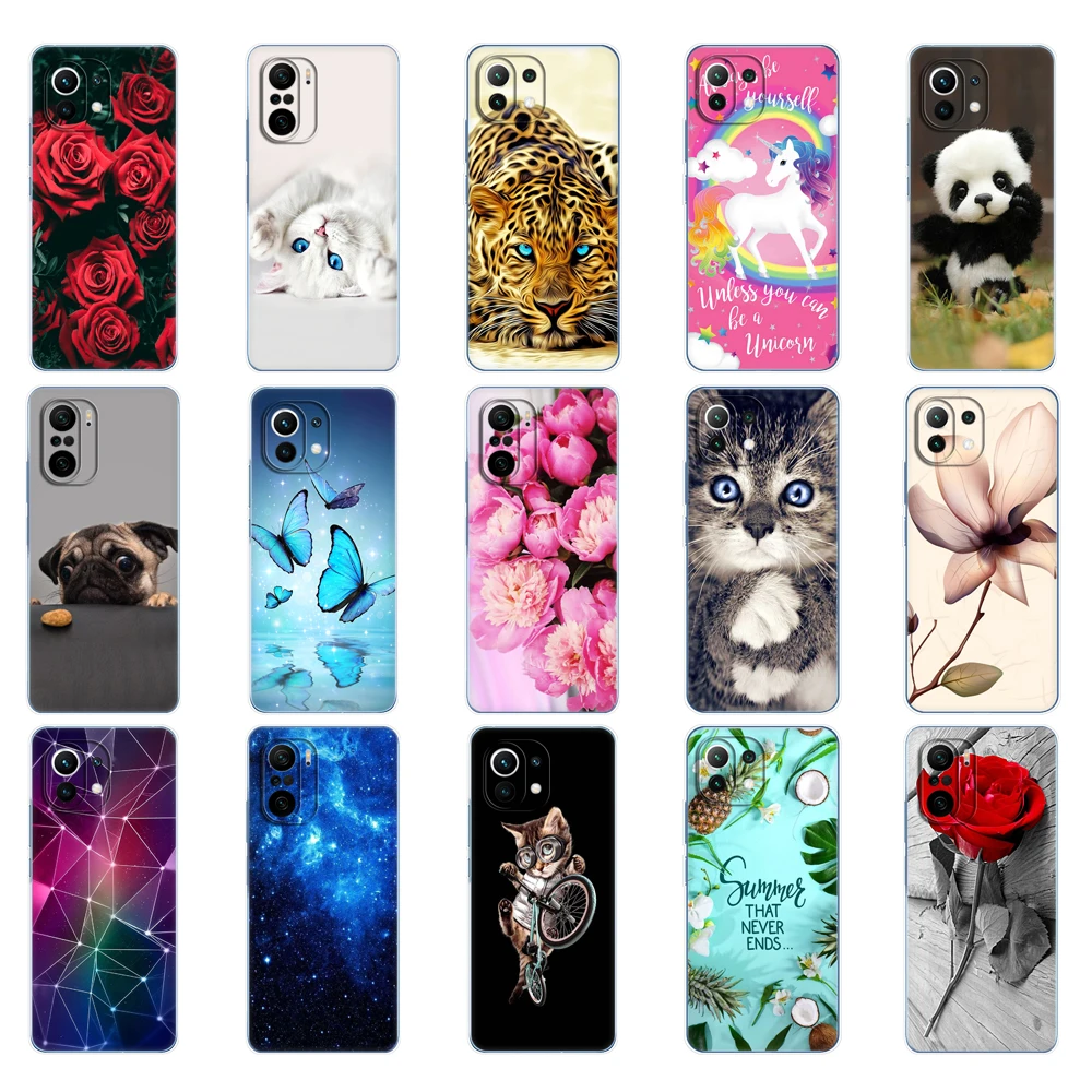 For xiaomi Mi 11 Mi 11 Lite 4G 5G NE Mi 11i Mi 11 Ultra Case Back For xiaomi11 i 11Lite Phone Cover Xiomi Mi11Lite Silicon TPU