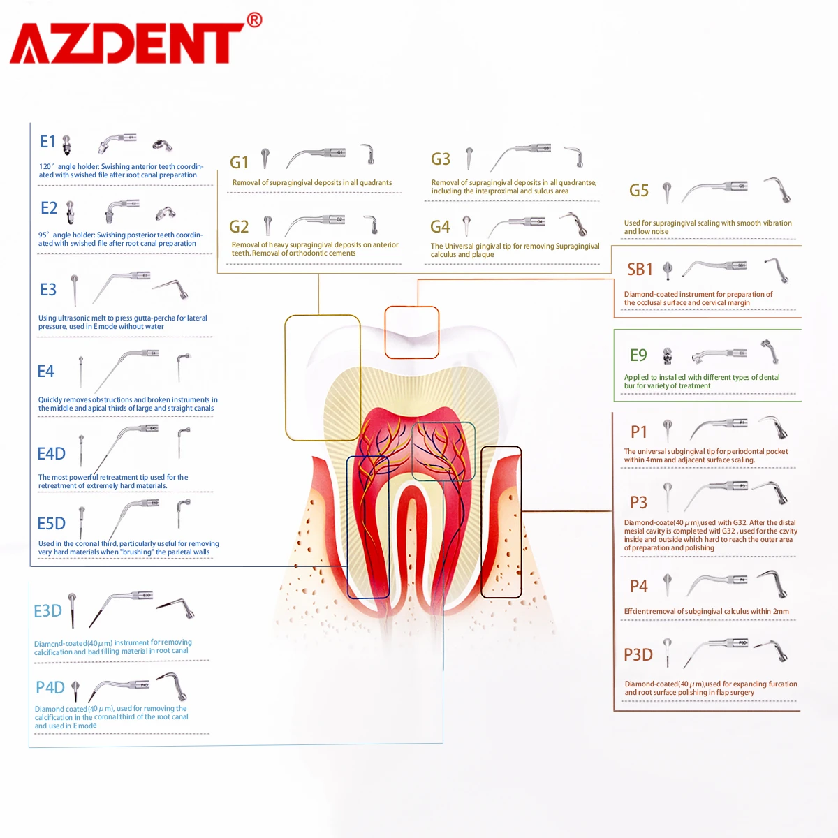 AZDENT stomatologiczny skaler ultradźwiękowy końcówka skalowanie przyzębia endodontyka Endo Perio skalowanie porady G P E pasuje do rękojeści skalera