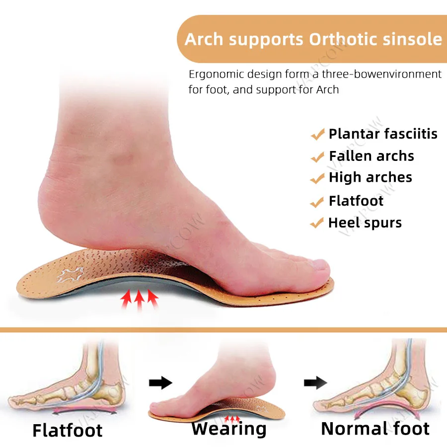 Leather orthotic insole for Flat Feet Arch Support orthopedic shoes sole Insoles for feet men women Children O/X Leg corrigibil