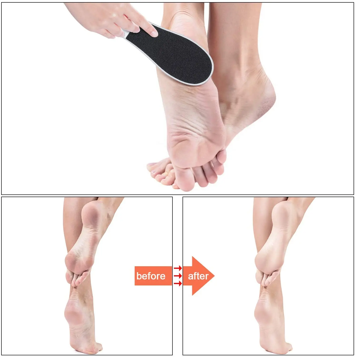 Double-Sided Foot File Rasp Foot Dead Skin Remover Foot Scrubber Hard Skin Remover Foot Care for Wet and Dry Cracked Feet