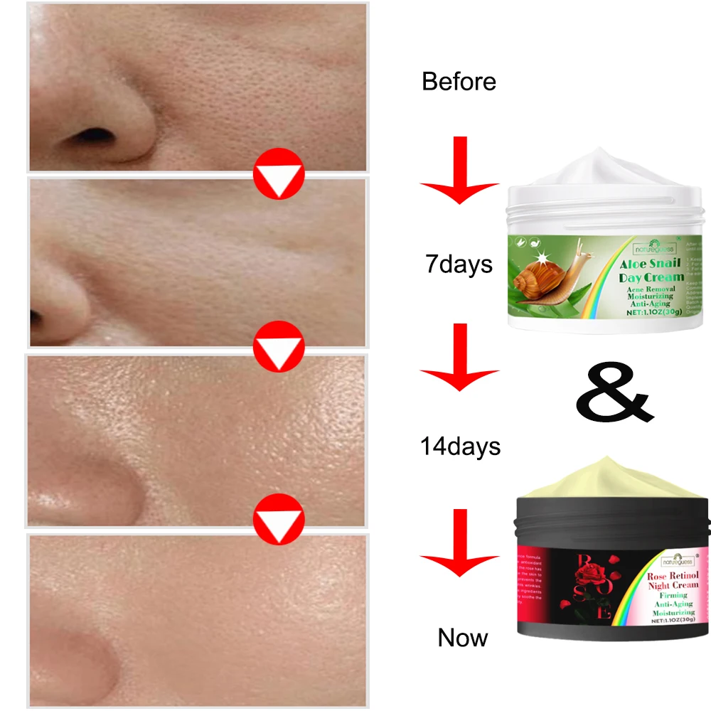Retinol Snail Aloe Face Cream Anti-Wrinkle Whitening Moisturizing Anti-Aging Facial Day Night Cream Skin Care Korean Cosmetics