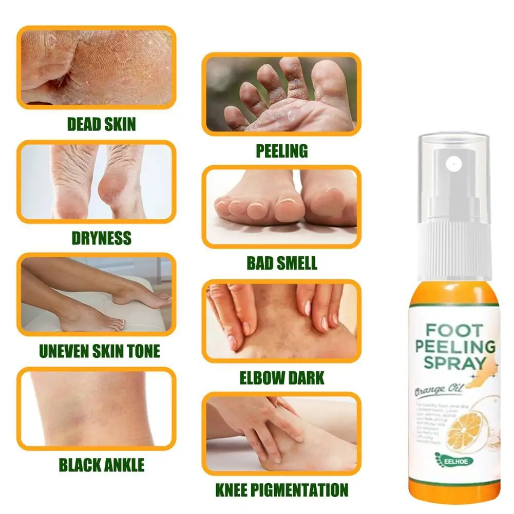 30 / 100ML Foot Exfoliating Spray Foot Peeling Dead Skin Remove Spray Natural Orange Essence Pedicure Hand Callus Whitening Care