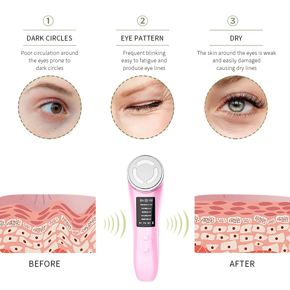 Radio Mesotherapie Gesichts Massager LED Photon Hautpflege Schönheit Gerät Gesicht Hebe Straffen Falten Entfernung Feuchtigkeitscreme