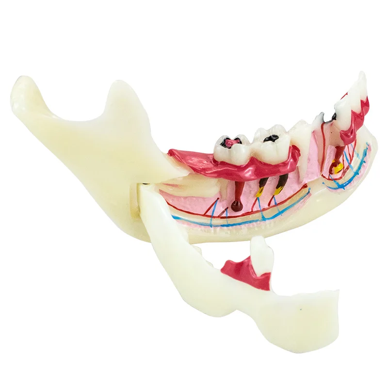 Dental Endodontic Treatment Model Anatomy of gums Dental Study Teach Model Dentistry Tooth Medical Science Disease Dentist gift