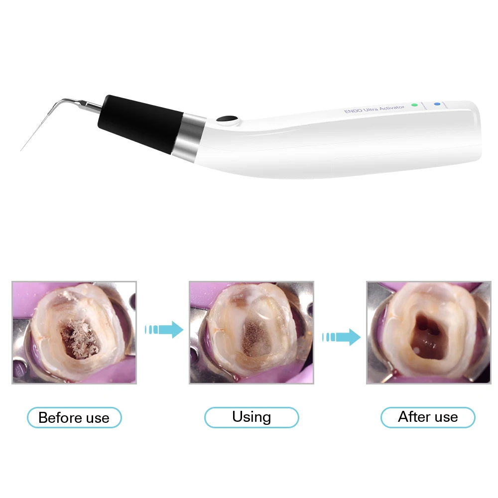 Dental Endo Ultra aktywator Endo Irrigator bezprzewodowa rękojeść ultradźwiękowa z 6 końcówkami 40-50Khz 1500mAh