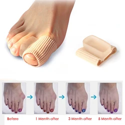 1/2pcsToe Separator Hallux Valgus Bunion Corrector Orthotics Feet Bone Thumb Adjuster Correction Pedicure Sock Straightener