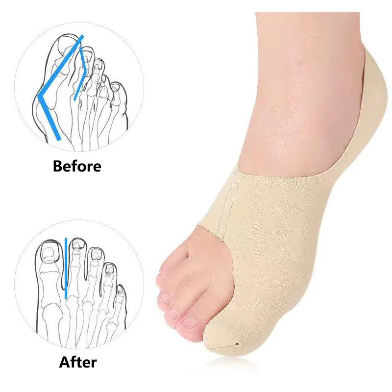 Protector de dedo gordo del Pie ajustable Unisex, calcetines suaves de pedicura para juanetes, vendaje Hallux Valgus ortopédico, cuidado de los