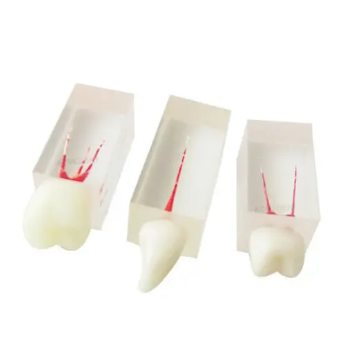 3Pcs Dental File Train RCT Root Canal Crown Study Practice Model Endodontic Pulp