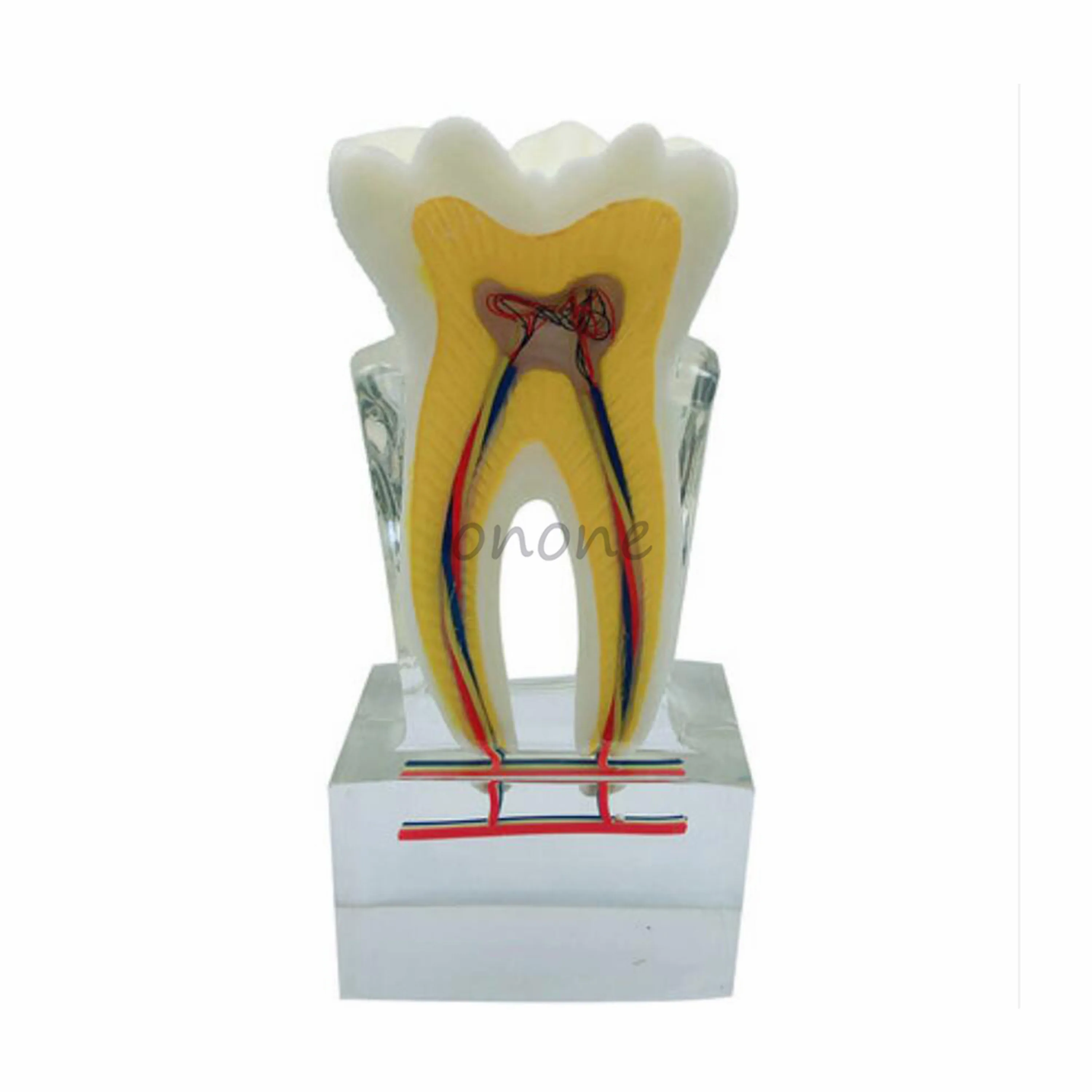 1pcs 6Times Dental Nerve Line Display Model Crystal Tooth Structure Snatomy Teaching model