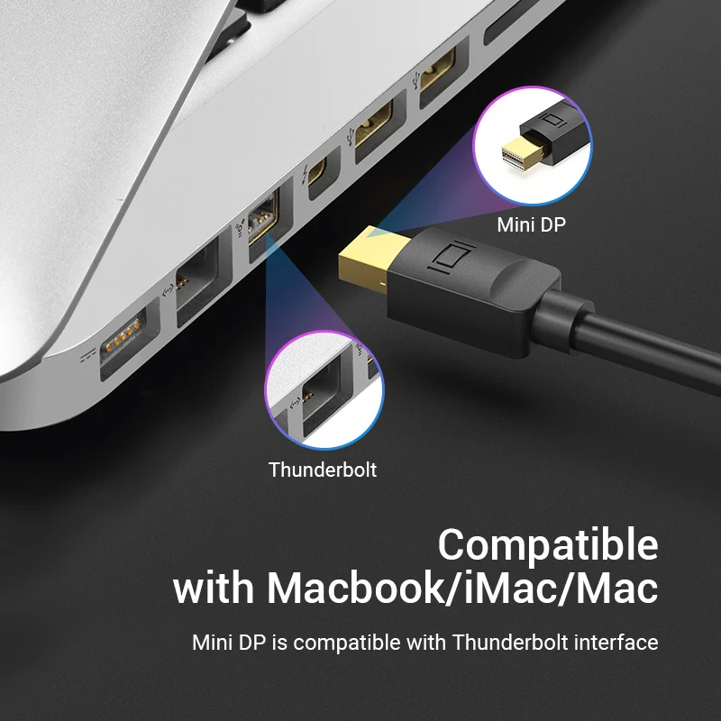 Vention Mini DisplayPort to HDMI Cable 1080P Mini Display Port Male to HDMI Male Cable for HDTV Apple MacBook Mini DP to HDMI