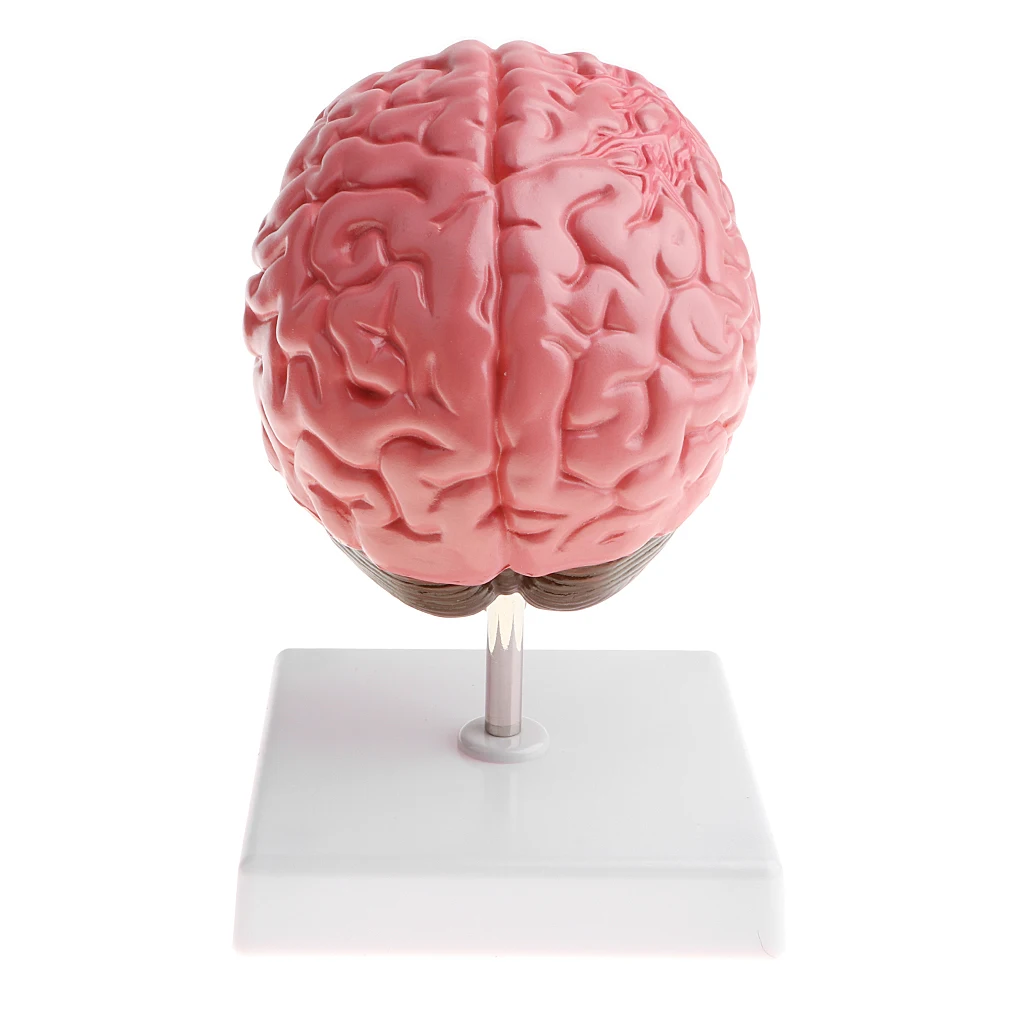 Anatomical Human\'s Brain Disease Pathological Model Medical Teaching Tool Lab Display Model School Educational Brain Model