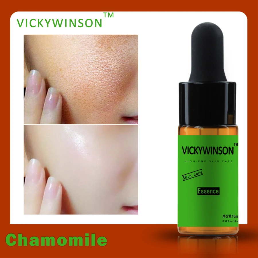 Chamomile Essence 10Ml เซรั่มต่อต้านริ้วรอย Essence Anti-Aging ลบ Puffiness Dark Circles Moisturizing Firming Eye Care