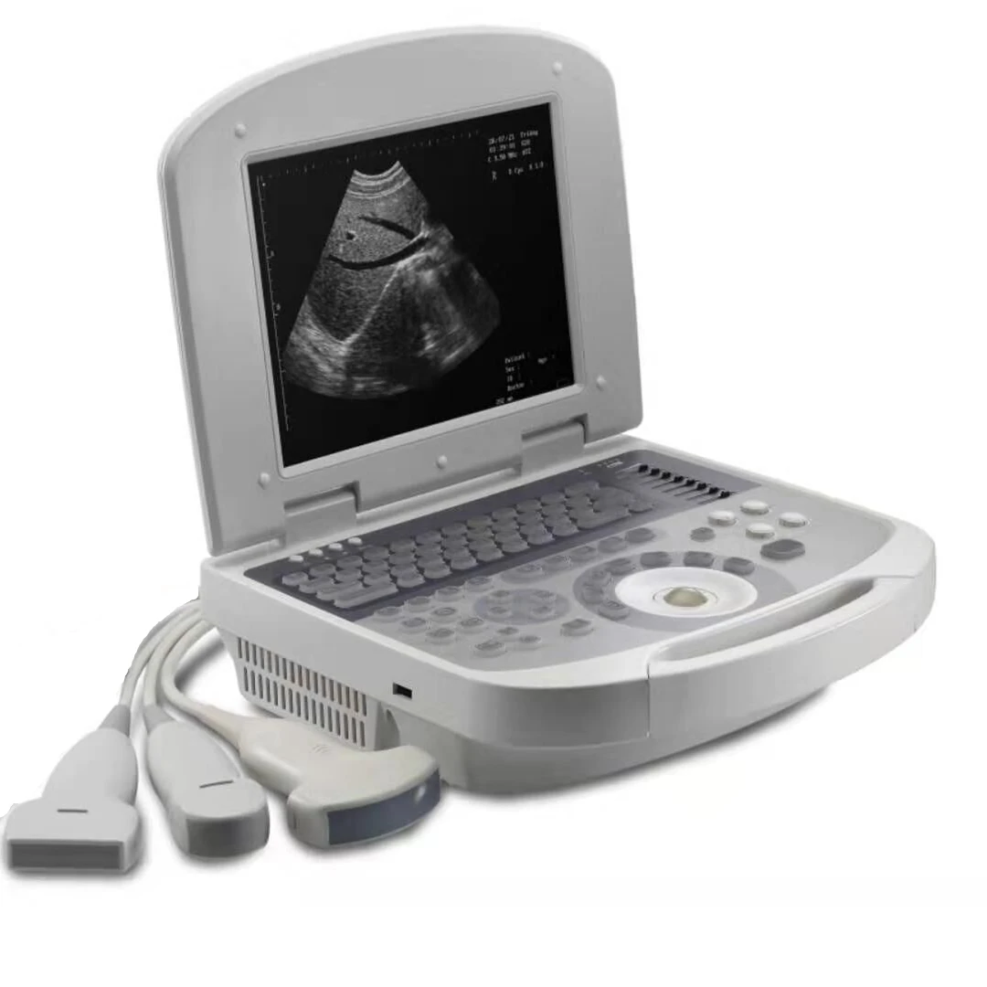 Veterinary 10 Inch Lcd Notebook B Ultrasound Scanner NS2200VET