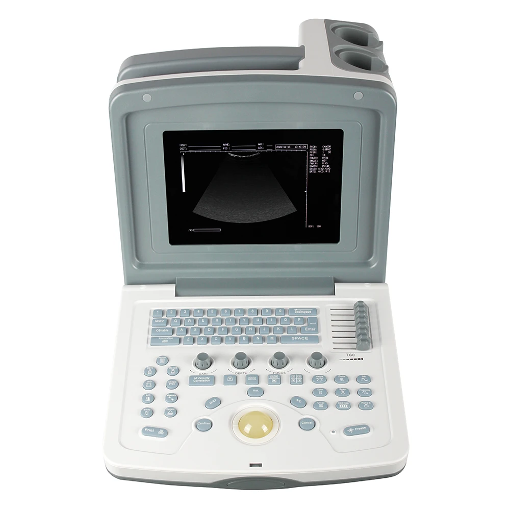 Medical Ultrasound Instrument SINOHERO S880 Handheld High Image Quality Hospital Clinic Use Portable Utrasound Scanner Machine