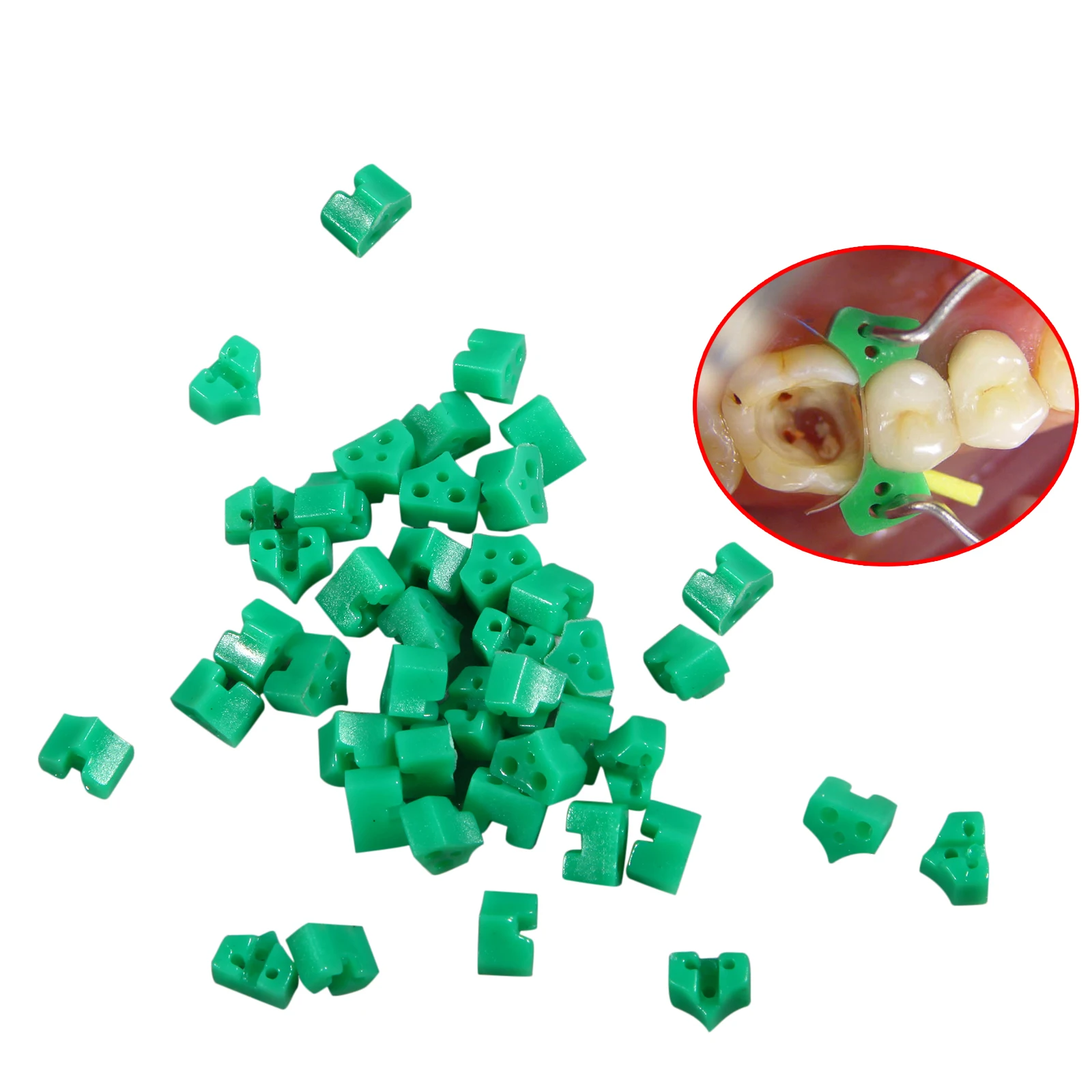 1/5/10pack Dental Add On Wedges Orthodontic Special Silicone Rubber Material High Quality