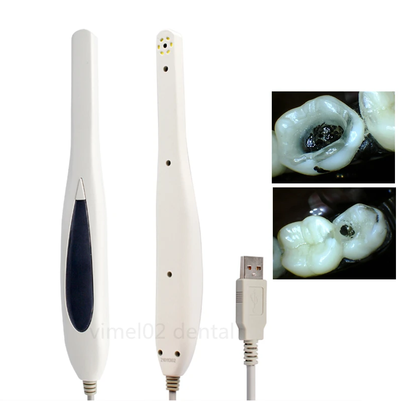 Portable Mini USB 2.0 Dental Intraoral Camera with  6PCS White LEDs for windows system computer