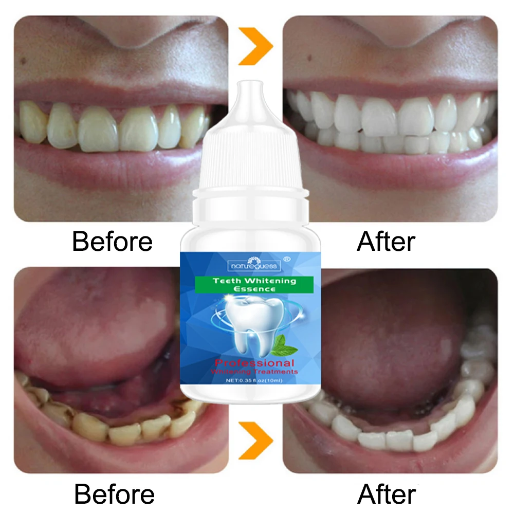 Teeth Whitening Essence Powder Clean Oral Hygiene Whiten Teeth Remove Plaque Stains Fresh Breath Oral Hygiene Dental Tools