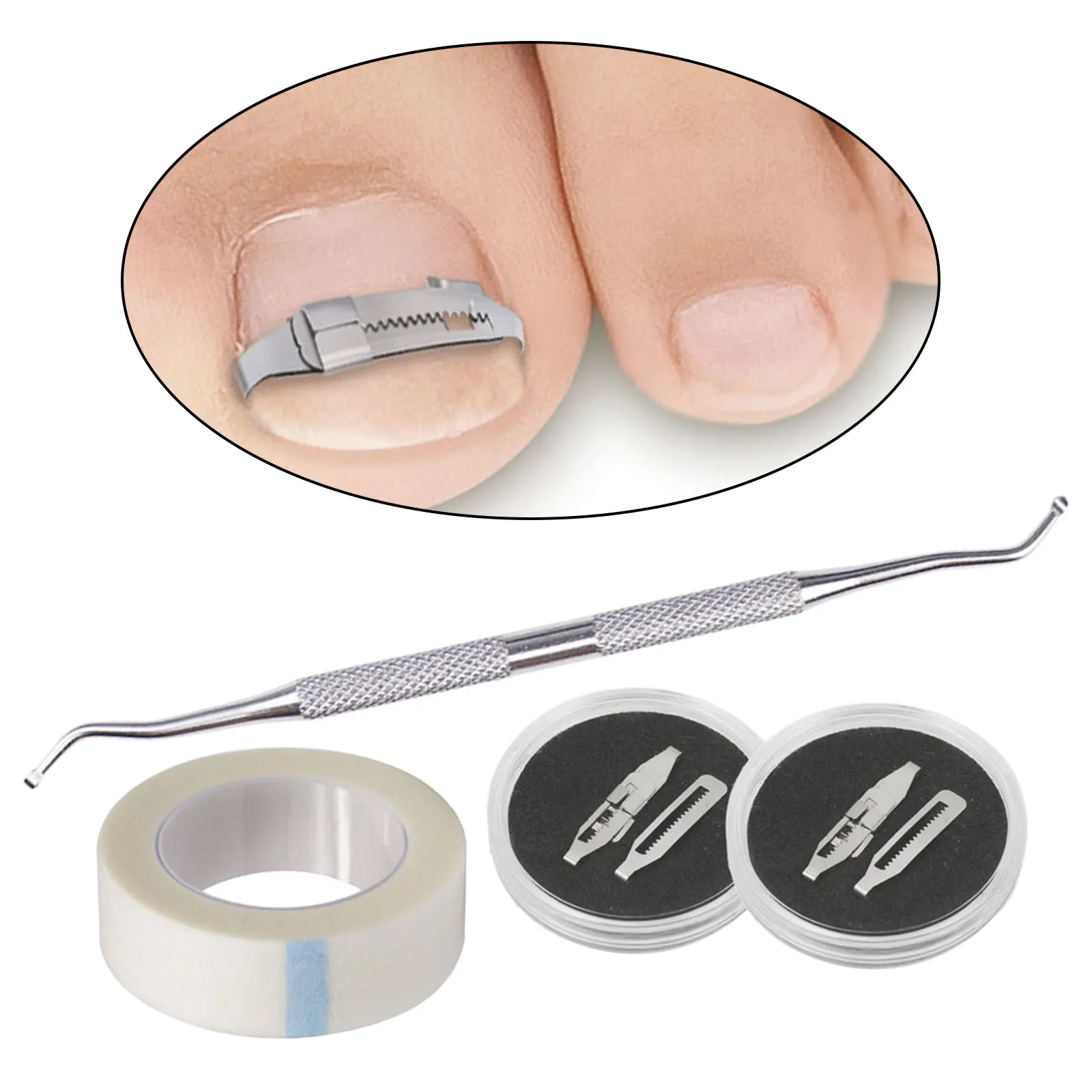 Ingrown Toenail Corrector Correction Buckle Pedicure Carbon Steel Foot Care Embed Toe Nails Treatment Paronychia Treatment