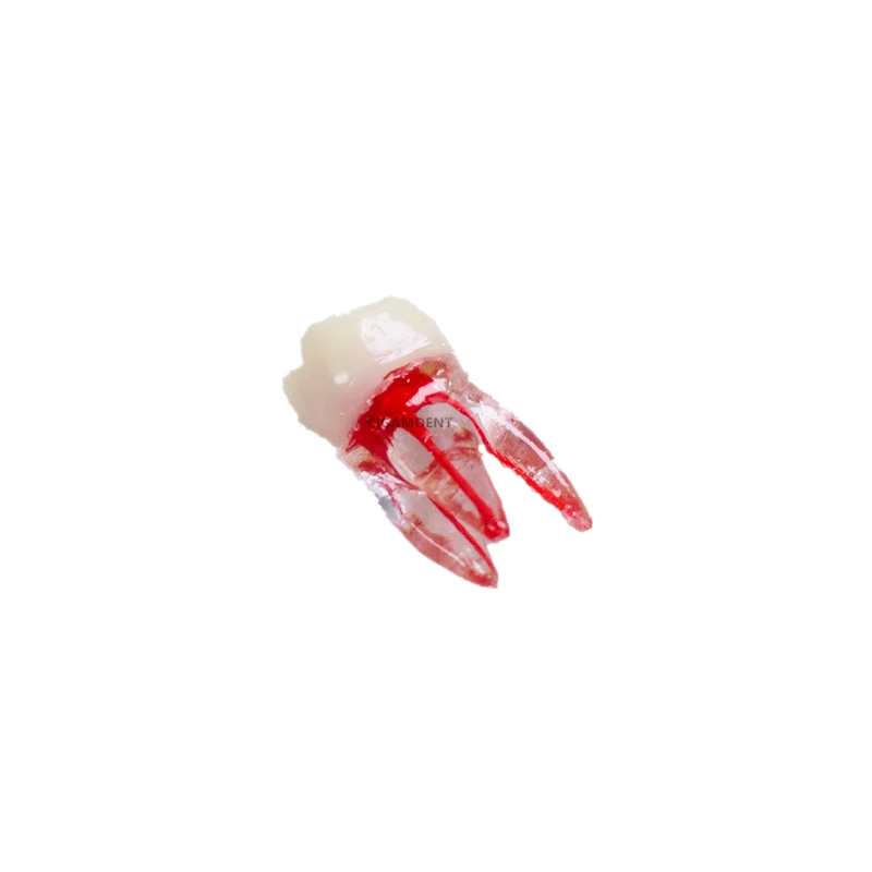 Dental Typodont Tooth Endo Root Canal Study Model For RCT Practice Block Pulp Cavity Endodontic Files