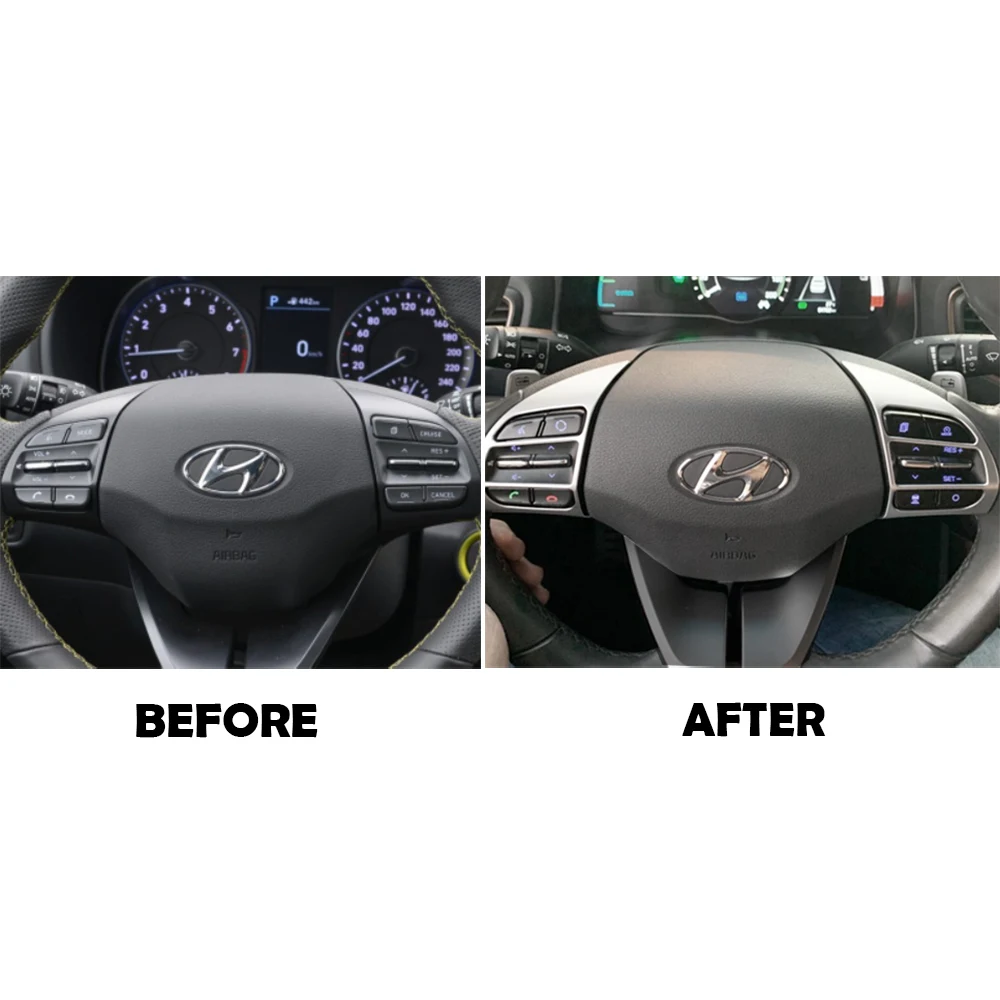 Car Accessories Carbon Fiber Look Steering Wheel Button Bezel Molding Sticker For Hyundai Kona 2018 2019 2020 2021 2022