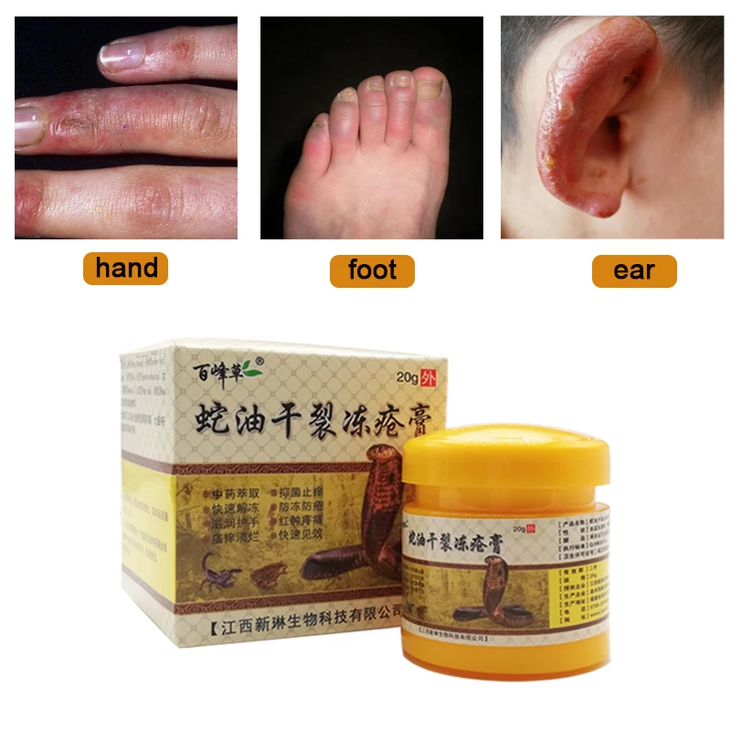 

20G Snake Oil Chilblain Cream Protect Skin Prevent Frostbite Moisturize Hands Moisturizing Made From Herbs Medical Plaster