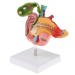 1:1 Life Size Anatomical Human Pancreas Duodenum Gallbladder Pathology Model, Lab Office Equipment Ornament for Students