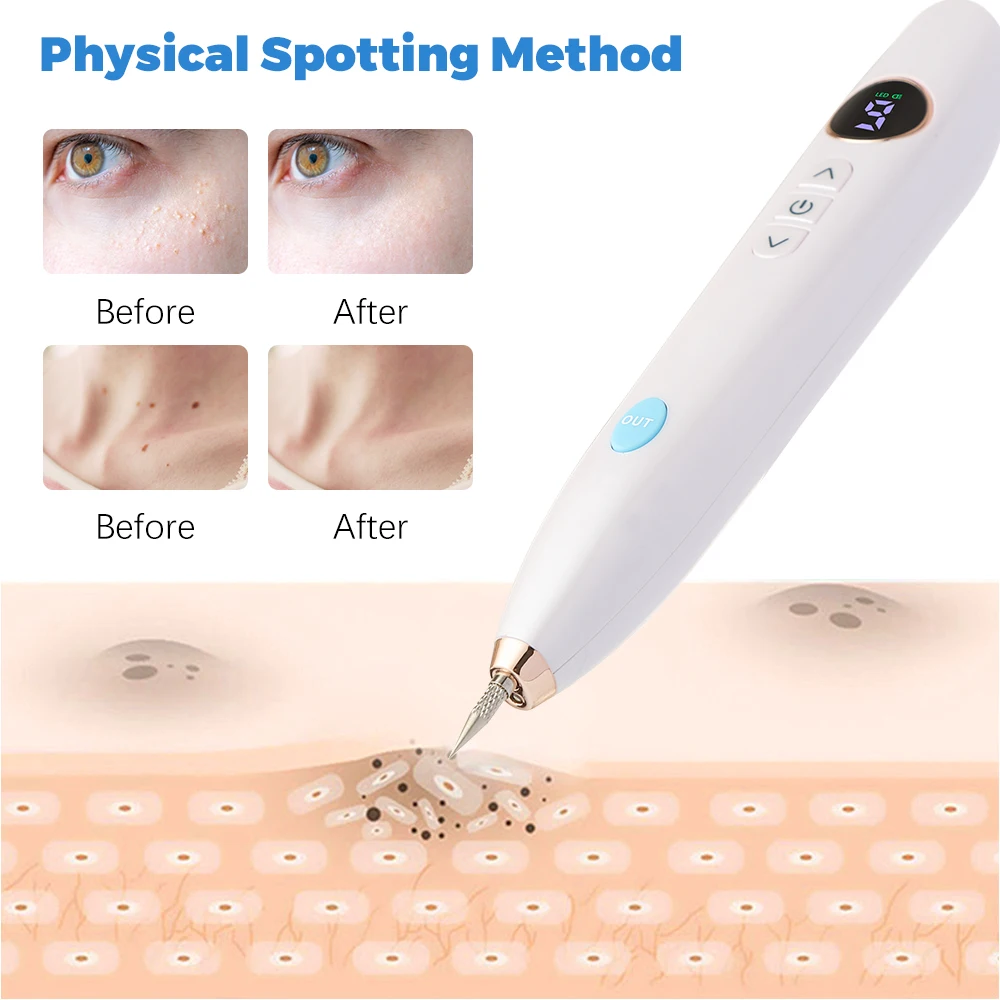 Skin Tag Remover Warts Eliminator Lcd Plasma Pen Papillomas Electric Laser Tattoo Removal Freckle Dark Spot Mole Cauterizer Kit