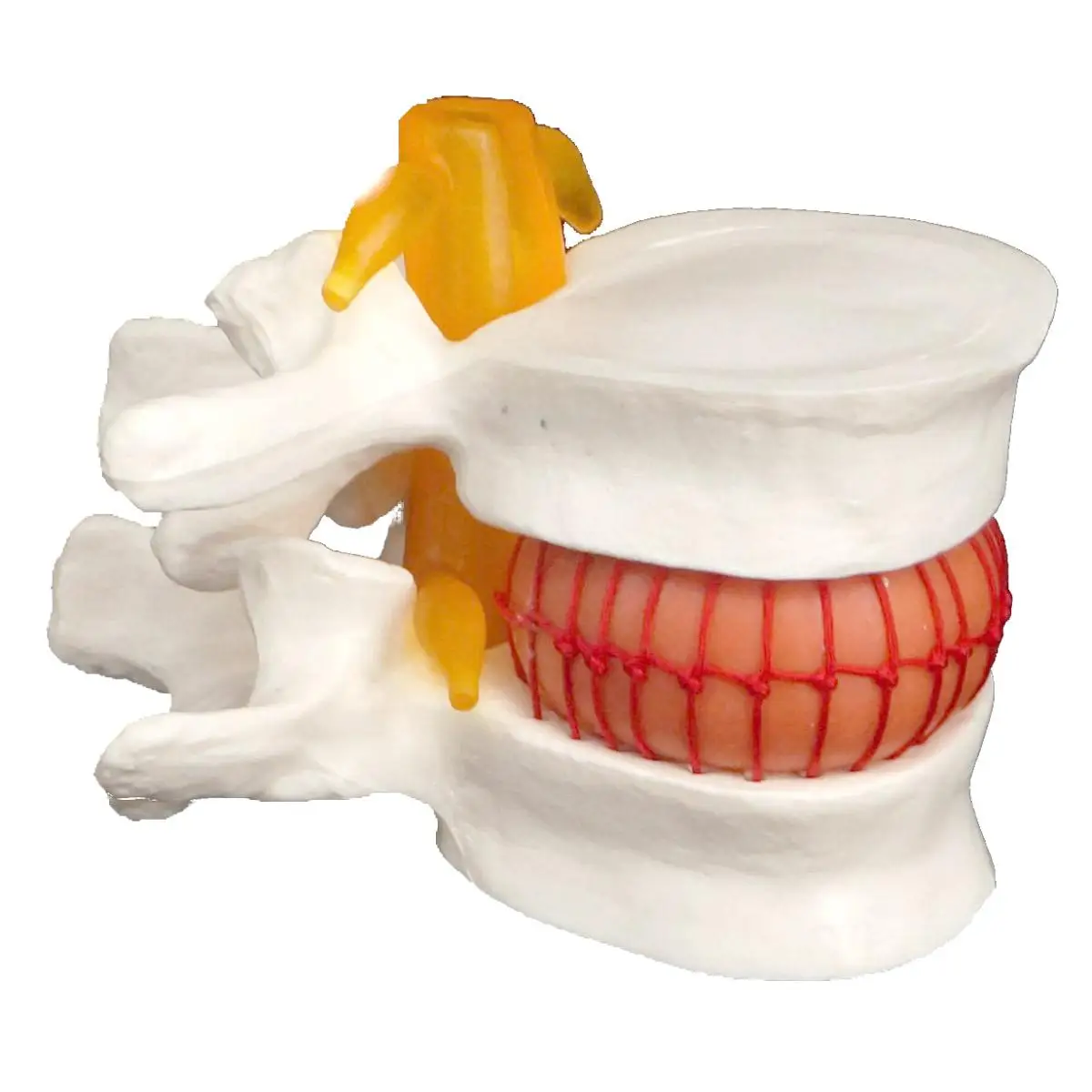 Model Lumbar manusia cakram anatomi medis herniasi bantuan pembelajaran Instrume latihan mengajar pendidikan alat bantu