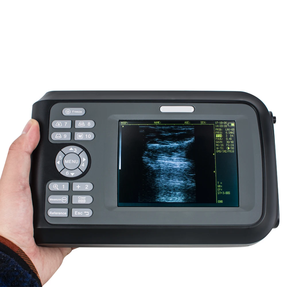 

Digital PalmSmart VET Ultrasonic Scanner 7mhz with Rectal probe for Veterinary cattle and horse