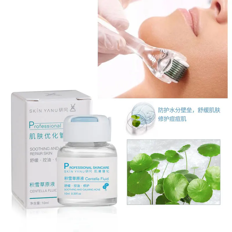 Centella Asiatica face serum Liquid Acne Treatment 10 Ml  Oil-Control Repair Smallpox Diluting Facial Ampoule Extract